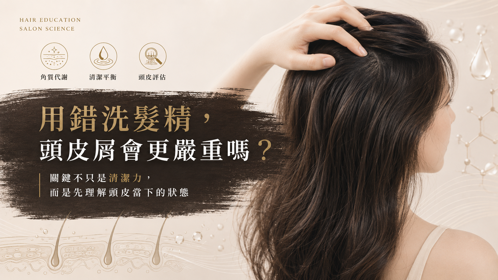 用錯洗髮精，頭皮屑會更嚴重嗎？頭皮清潔平衡、角質代謝與頭皮評估示意圖